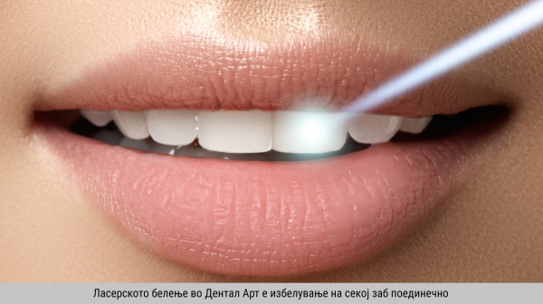 Why laser teeth whitening at Dental Art?