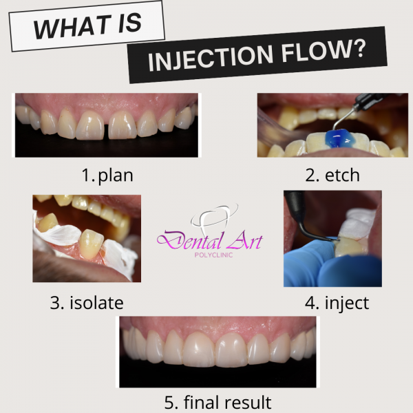 Што е injection flow техника?